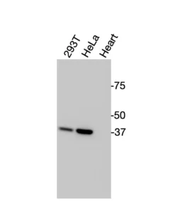 Western blot analysis of endogenous RARγ in HEK293T, HeLa, and mouse heart lysates using Anti-RARγ Recombinant Monoclonal Antibody (XM0044)