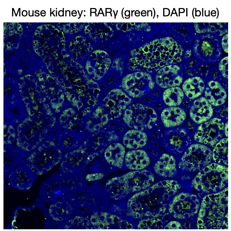 Immunofluorescence staining of endogenous mouse RARγ in kidney tissue, showing RARγ in green and DAPI-stained nuclei in blue