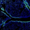 Immunofluorescence staining of endogenous mouse CTNNA1 (Catenin alpha-1) in lung tissue, showing CTNNA1 in green and DAPI-stained nuclei in blue