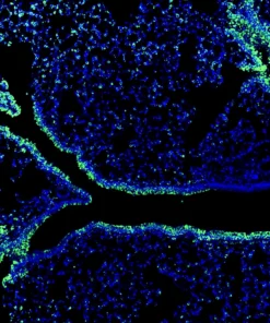 Immunofluorescence staining of endogenous mouse CTNNA1 (Catenin alpha-1) in lung tissue, showing CTNNA1 in green and DAPI-stained nuclei in blue