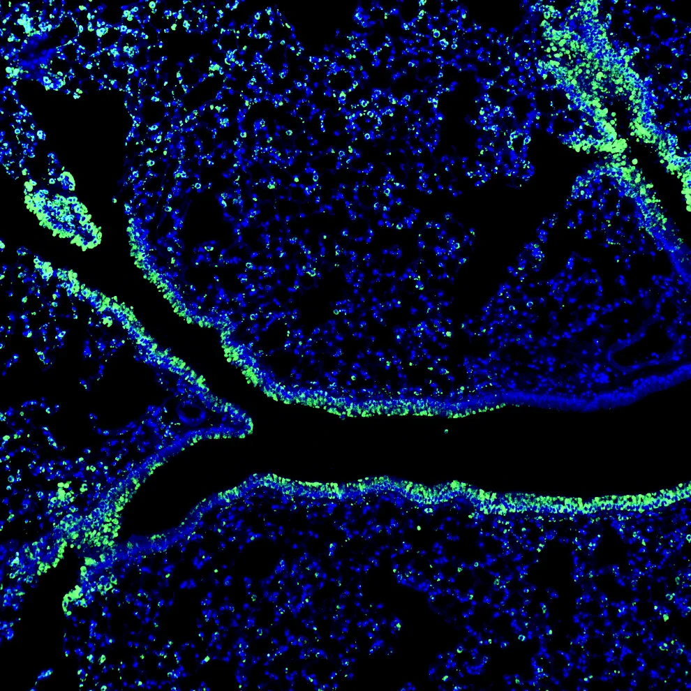 Immunofluorescence staining of endogenous mouse CTNNA1 (Catenin alpha-1) in lung tissue, showing CTNNA1 in green and DAPI-stained nuclei in blue
