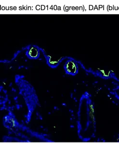 Immunofluorescence staining of endogenous mouse CD140a (PDGFRα) in skin tissue, showing CD140a in green and DAPI-stained nuclei in blue