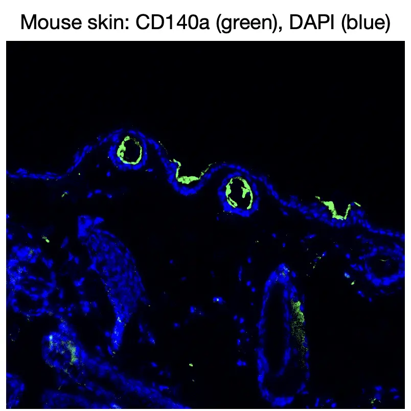 Immunofluorescence staining of endogenous mouse CD140a (PDGFRα) in skin tissue, showing CD140a in green and DAPI-stained nuclei in blue