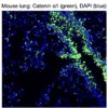 Immunofluorescence staining of endogenous mouse CTNNA1 (Catenin alpha-1) in lung tissue, showing CTNNA1 in green and DAPI-stained nuclei in blue