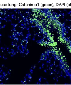Immunofluorescence staining of endogenous mouse CTNNA1 (Catenin alpha-1) in lung tissue, showing CTNNA1 in green and DAPI-stained nuclei in blue