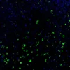 Immunofluorescence staining of endogenous mouse Merlin (NF2) in brain tissue, showing Merlin in green and DAPI-stained nuclei in blue