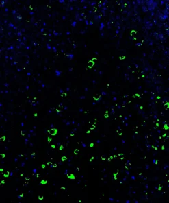 Immunofluorescence staining of endogenous mouse Merlin (NF2) in brain tissue, showing Merlin in green and DAPI-stained nuclei in blue
