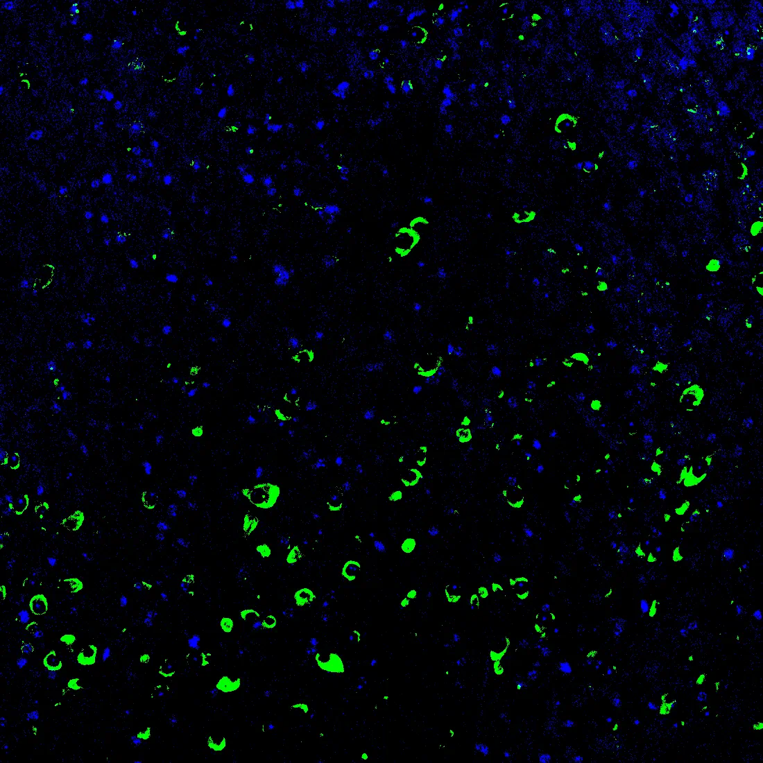 Immunofluorescence staining of endogenous mouse Merlin (NF2) in brain tissue, showing Merlin in green and DAPI-stained nuclei in blue