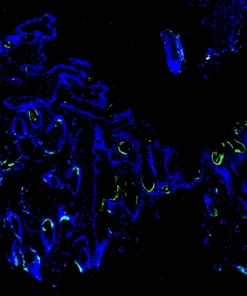 Immunofluorescence staining of endogenous mouse CD140a (PDGFRα) in skin tissue, showing CD140a in green and DAPI-stained nuclei in blue