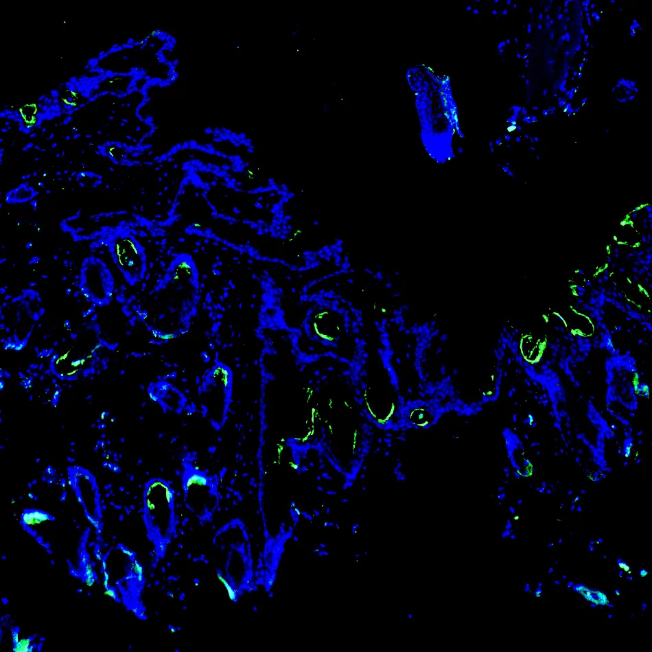 Immunofluorescence staining of endogenous mouse CD140a (PDGFRα) in skin tissue, showing CD140a in green and DAPI-stained nuclei in blue