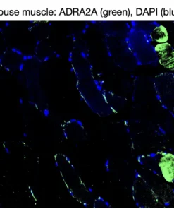 Immunofluorescence staining of endogenous mouse ADRA2A in skeletal muscle tissue, showing ADRA2A in green and DAPI-stained nuclei in blue.