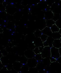 Immunofluorescence staining of endogenous mouse LXRα in epididymal white adipose tissue (eWAT), showing LXRα in green and DAPI-stained nuclei in blue.