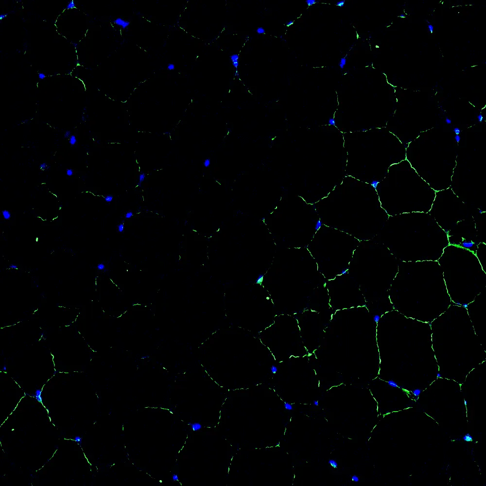 Immunofluorescence staining of endogenous mouse LXRα in epididymal white adipose tissue (eWAT), showing LXRα in green and DAPI-stained nuclei in blue.