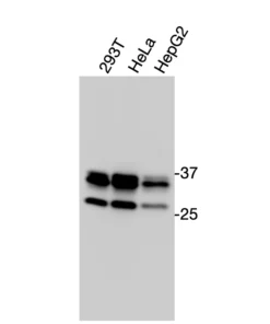 Western blot analysis of endogenous human CCR10 in 293T, HeLa, and HepG2 cell lysates using Anti-human CCR10 Recombinant Monoclonal Antibody (HM0074)