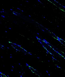 Immunofluorescence staining of endogenous mouse RXRα in skeletal muscle tissue, showing RXRα in green and DAPI-stained nuclei in blue.