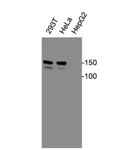 Western blot analysis of endogenous human CXCR2 in 293T and HeLa cell lysates using Anti-human CXCR2 Recombinant Monoclonal Antibody (HM0076)