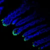 Immunofluorescence staining of endogenous mouse VDR in intestine tissue, showing VDR in green and DAPI-stained nuclei in blue