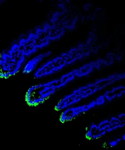 Immunofluorescence staining of endogenous mouse VDR in intestine tissue, showing VDR in green and DAPI-stained nuclei in blue