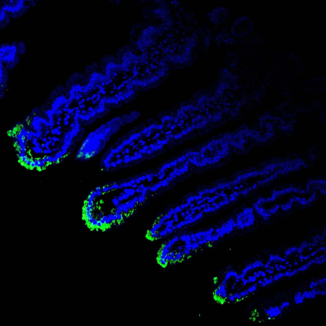 Immunofluorescence staining of endogenous mouse VDR in intestine tissue, showing VDR in green and DAPI-stained nuclei in blue