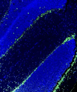Immunofluorescence staining of endogenous mouse glucocorticoid receptor (GR) in brain tissue, showing GR in green and DAPI-stained nuclei in blue.