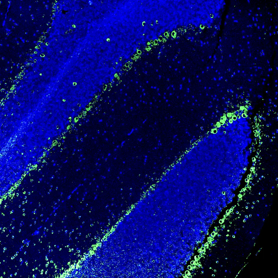 Immunofluorescence staining of endogenous mouse glucocorticoid receptor (GR) in brain tissue, showing GR in green and DAPI-stained nuclei in blue.