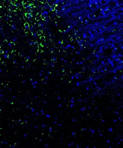 Immunofluorescence staining of endogenous mouse CAR in brain tissue, showing CAR in green and DAPI-stained nuclei in blue