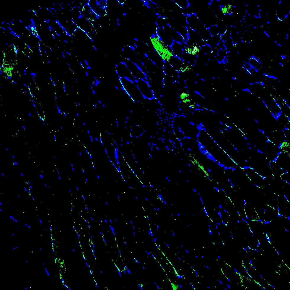 Immunofluorescence staining of endogenous mouse ADRA2A in skeletal muscle tissue, showing ADRA2A in green and DAPI-stained nuclei in blue.