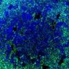 Immunofluorescence staining of endogenous mouse ERR1 (ESRRA) in kidney tissue, showing ERR1 in green and DAPI-stained nuclei in blue