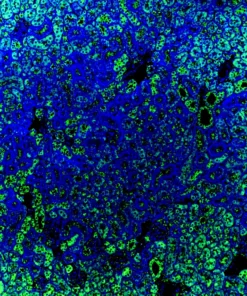 Immunofluorescence staining of endogenous mouse ERR1 (ESRRA) in kidney tissue, showing ERR1 in green and DAPI-stained nuclei in blue