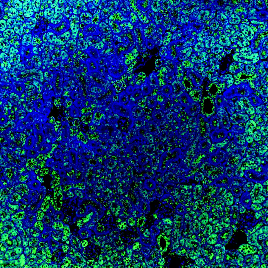 Immunofluorescence staining of endogenous mouse ERR1 (ESRRA) in kidney tissue, showing ERR1 in green and DAPI-stained nuclei in blue