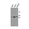 Western blot analysis of endogenous human DRD3 in HEK293T, HeLa, and HepG2 cell lysates using Anti-human DRD3 Recombinant Monoclonal Antibody (HM0079)