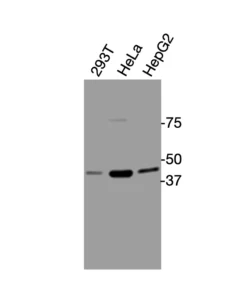 Western blot analysis of endogenous human DRD3 in HEK293T, HeLa, and HepG2 cell lysates using Anti-human DRD3 Recombinant Monoclonal Antibody (HM0079)