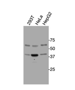 Western blot analysis of endogenous human NPFFR2 (GPR74) in HEK293T, HeLa, and HepG2 cell lysates using Anti-human NPFFR2 Recombinant Monoclonal Antibody (HM0083)