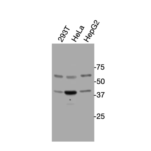 Western blot analysis of endogenous human NPFFR2 (GPR74) in HEK293T, HeLa, and HepG2 cell lysates using Anti-human NPFFR2 Recombinant Monoclonal Antibody (HM0083)