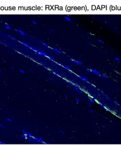 Immunofluorescence staining of endogenous mouse RXRα in skeletal muscle tissue, showing RXRα in green and DAPI-stained nuclei in blue.