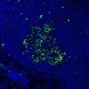 Immunofluorescence staining of endogenous mouse RORγ in lymph node tissue, showing RORγ in green and DAPI-stained nuclei in blue