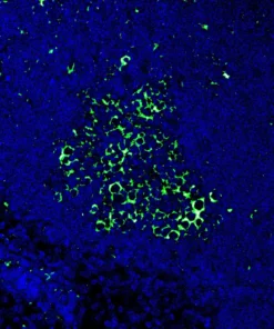 Immunofluorescence staining of endogenous mouse RORγ in lymph node tissue, showing RORγ in green and DAPI-stained nuclei in blue