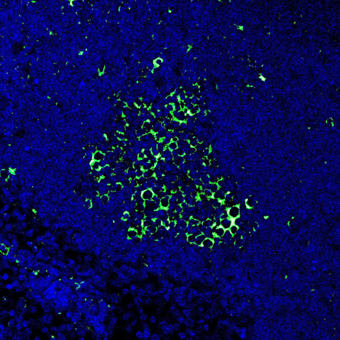 Immunofluorescence staining of endogenous mouse RORγ in lymph node tissue, showing RORγ in green and DAPI-stained nuclei in blue