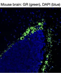 Immunofluorescence staining of endogenous mouse glucocorticoid receptor (GR) in brain tissue, showing GR in green and DAPI-stained nuclei in blue.