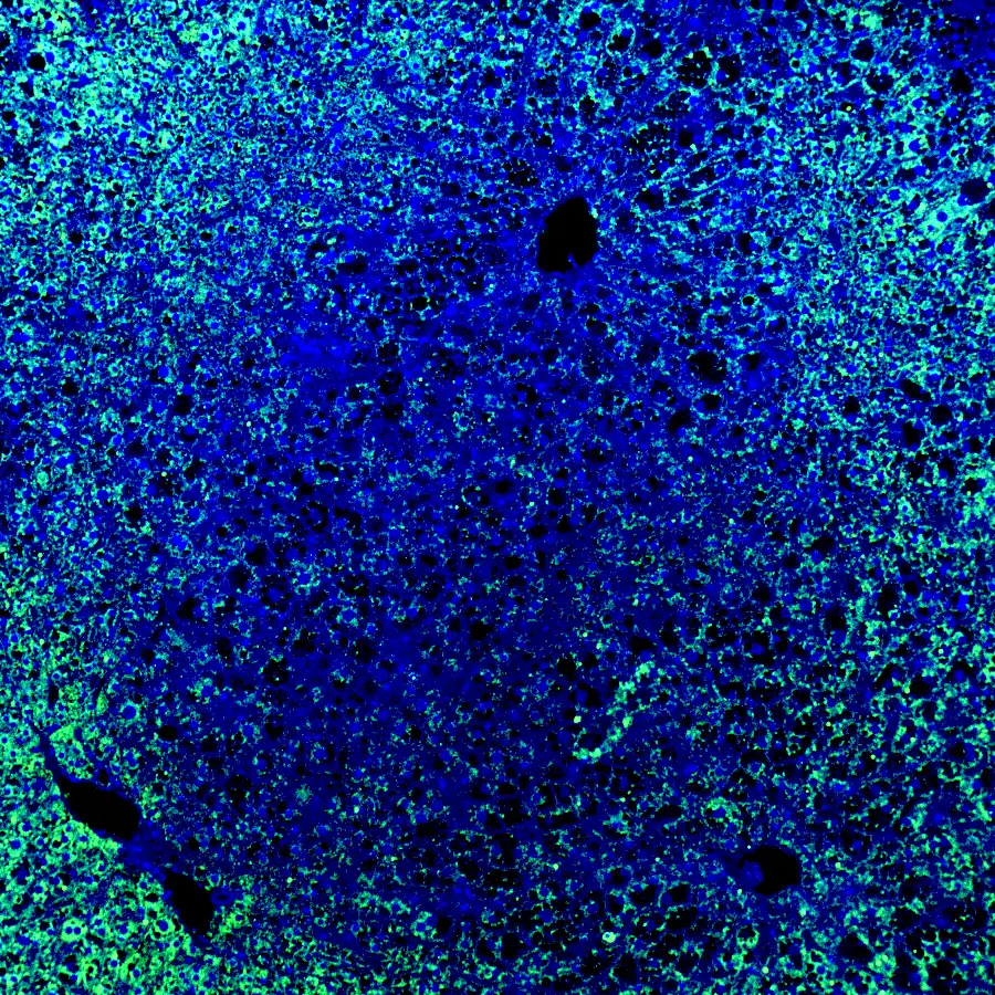 Immunofluorescence staining of endogenous mouse SAV1 in brain tissue, showing SAV1 in green and DAPI-stained nuclei in blue.