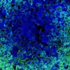Immunofluorescence staining of endogenous mouse RARγ in kidney tissue, showing RARγ in green and DAPI-stained nuclei in blue