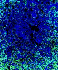 Immunofluorescence staining of endogenous mouse RARγ in kidney tissue, showing RARγ in green and DAPI-stained nuclei in blue