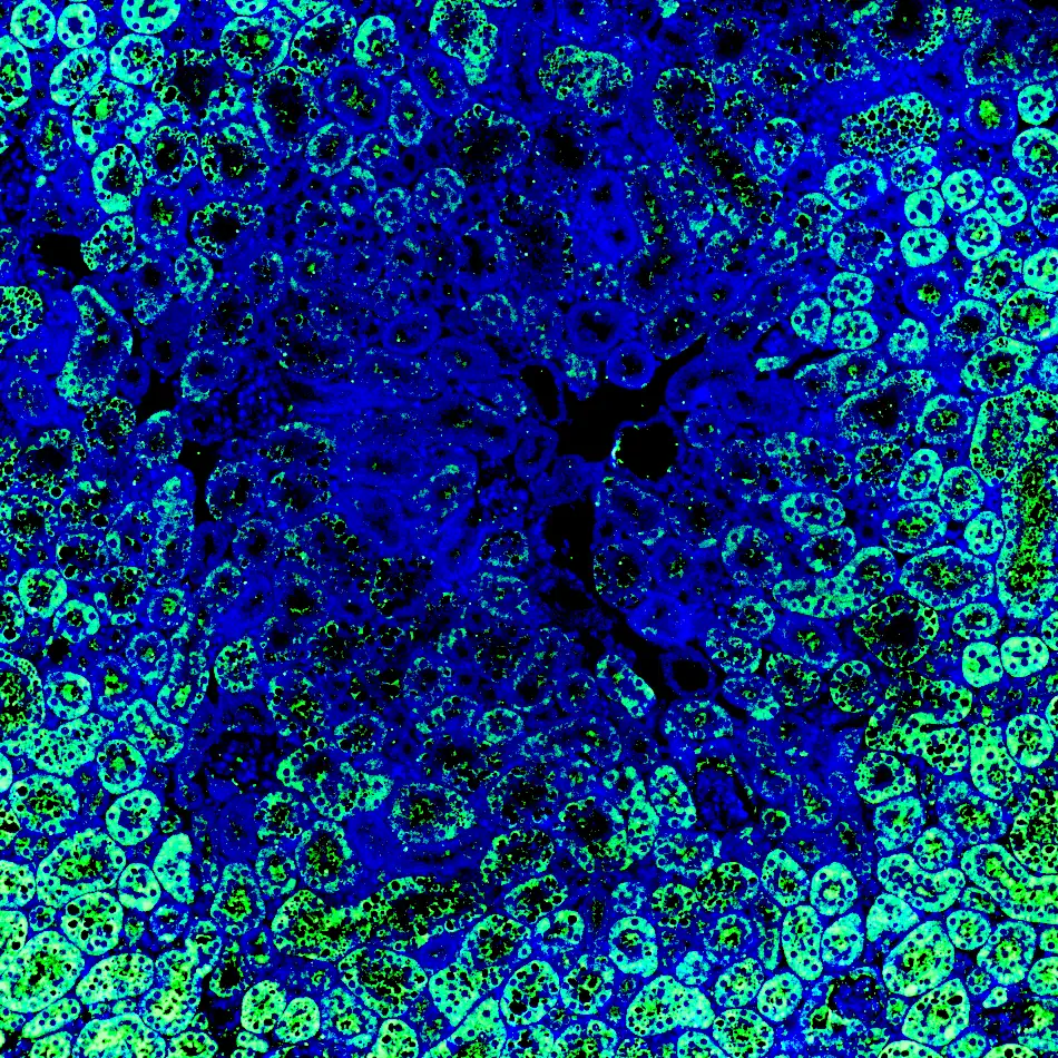 Immunofluorescence staining of endogenous mouse RARγ in kidney tissue, showing RARγ in green and DAPI-stained nuclei in blue