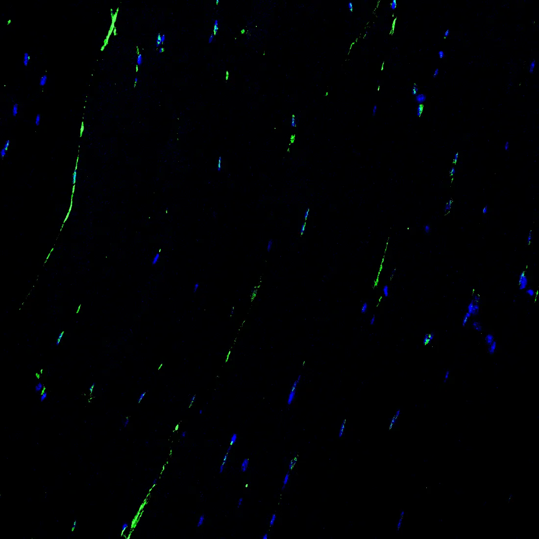 Immunofluorescence staining of endogenous DAG1 in mouse muscle, showing DAG1 in green and DAPI-stained nuclei in blue.