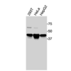 Western blot analysis of endogenous human LXRα in 293T, HeLa, and HepG2 cell lysates using Anti-human LXRα Recombinant Monoclonal Antibody (MM0004)