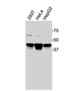 Western blot analysis of endogenous human LXRα in 293T, HeLa, and HepG2 cell lysates using Anti-human LXRα Recombinant Monoclonal Antibody (MM0004)