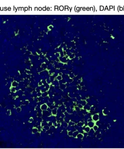 Immunofluorescence staining of endogenous mouse RORγ in lymph node tissue, showing RORγ in green and DAPI-stained nuclei in blue