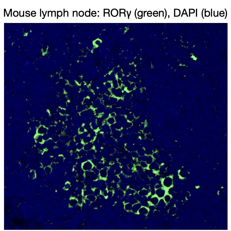 Immunofluorescence staining of endogenous mouse RORγ in lymph node tissue, showing RORγ in green and DAPI-stained nuclei in blue