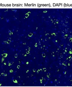 Immunofluorescence staining of endogenous mouse Merlin (NF2) in brain tissue, showing Merlin in green and DAPI-stained nuclei in blue