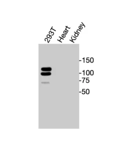 Western blot showing specific bands in HEK293T cell lysate, mouse heart, and kidney for CD140a antibody